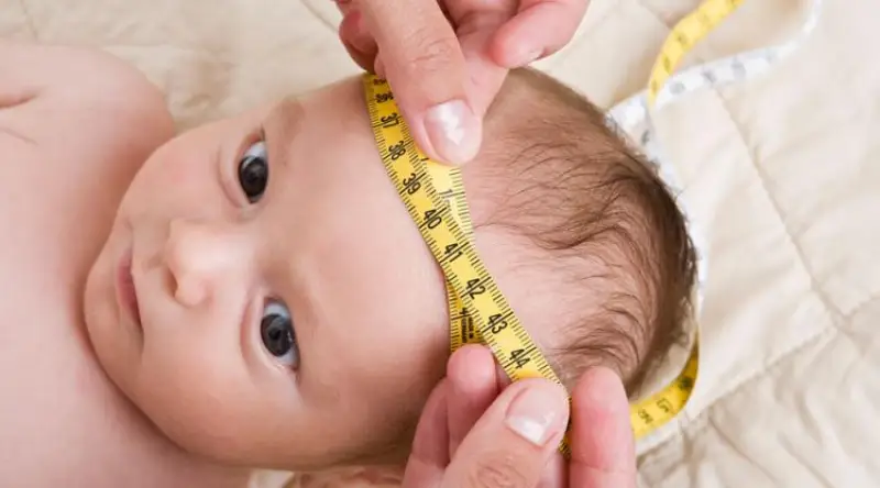 کاردرمانی کودکان هیدروسفالی